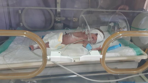 neonate