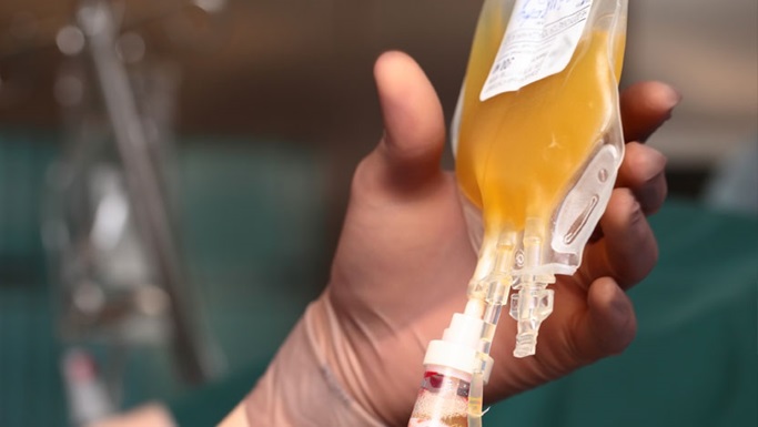 Plasma Transfusion